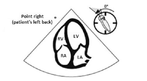 Apical 4-chamber view (adapted from http://www.fate-protocol.com/ with ...