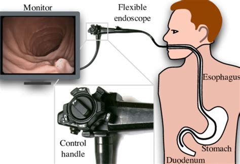 What Is the Difference Between Borescopes and Endoscopes? - The Frisky