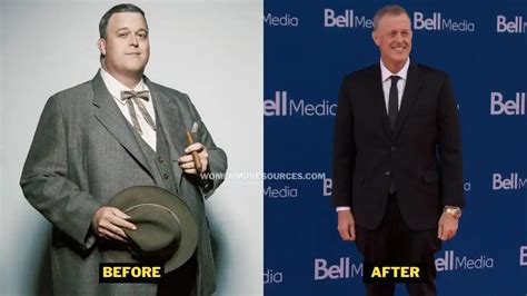 Billy Gardell Weight Loss. Bob Hearts Abishola Actor's Diet, Surgery ...