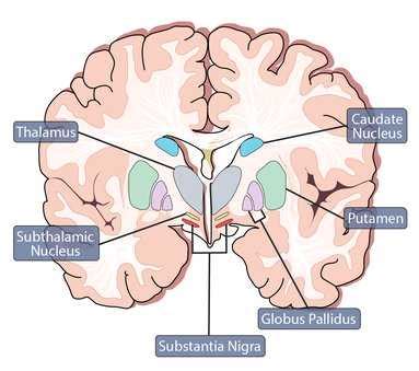 Parkinson's Disease Symptoms, Causes & Parkinsonism | MNC