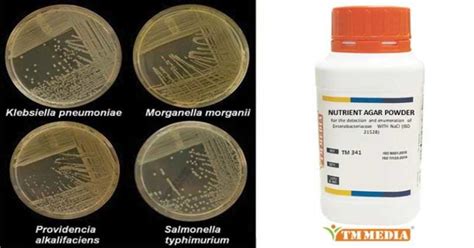 Nutrient Agar- Principle, Composition, Preparation, Results, Uses