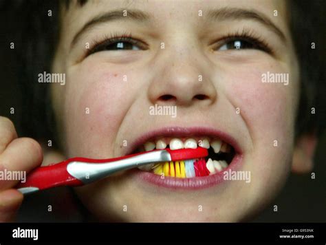 Milk teeth cavities hi-res stock photography and images - Alamy