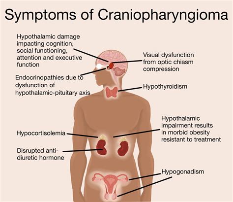 Targeted Therapy in the Management of Modern Craniopharyngiomas