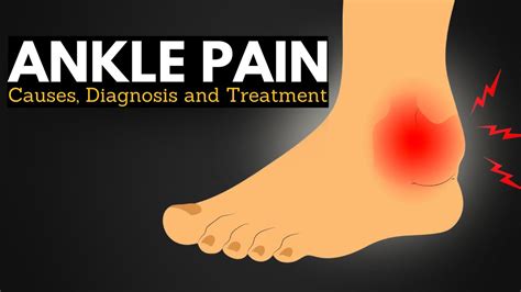 Ankle Pain Survival Guide: Walking Comfortably Through Causes and ...