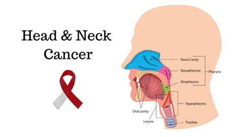 Cancer Types | Head and Neck Cancers - NFCR