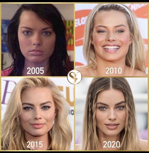 Pin by Krystal Waters on before and after | Celebrity plastic surgery ...