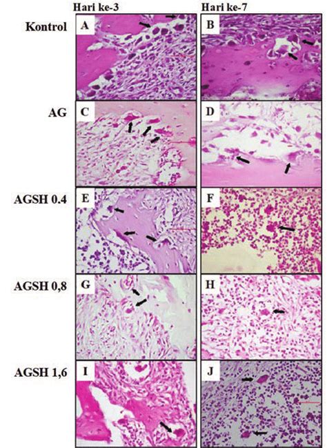 Histological section of osteoclast with application of bone graft from ...