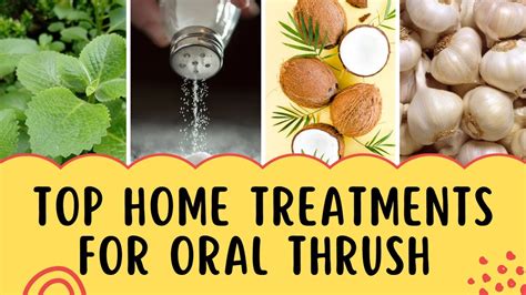 Top Home Treatments for Oral Thrush Yeast Infection aka Candida - YouTube