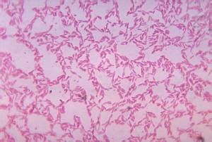 Bacteroides fragilis