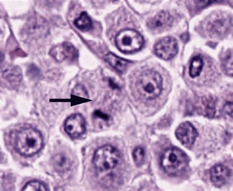 Mitotic Figure Quiz – The Davis-Thompson Foundation