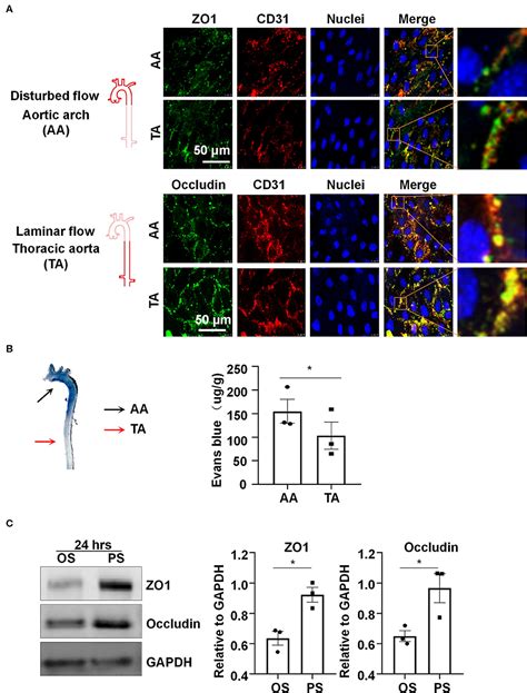 Frontiers | Laminar Flow Protects Vascular Endothelial Tight Junctions ...