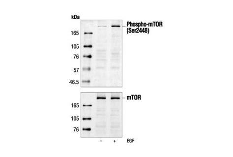 mTOR Antibody | Cell Signaling Technology