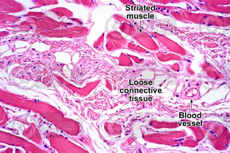 Mammal. Loose connective tissue. Transverse section. 125X - Loose connective tissue - Connective ...