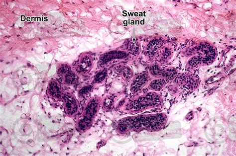 Man. Sweat gland. Vertical section. 250X - Sweat gland - Mammals - Integumentary system ...