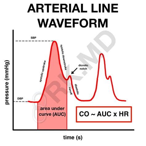 Pressure Transducers And Arterial Line Waveforms | RK.MD