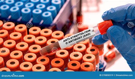 Anti-Streptolysin O Antibody (ASO) Test Tube with Blood Sample in Infection Lab Stock Image ...