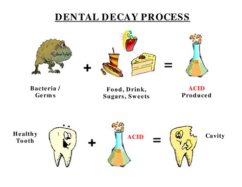 Common causes of dental cavities