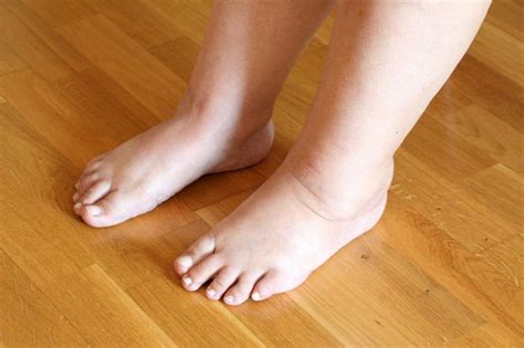 Diabetes Swollen Feet: Causes, Symptoms, Treatment & Prevention