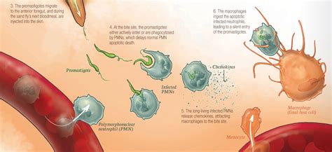 Leishmaniasis Pathophysiology