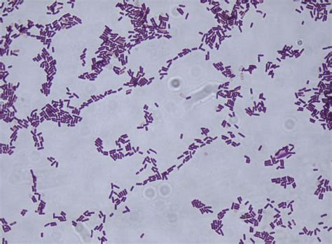 Bacillus subtilis gram stain