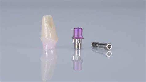 What is Dental Implant Abutment? Types and Cost