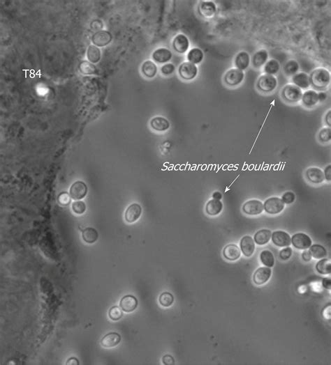 Epithelial Cells In Stool Microscopy | Decoration D'une Chambre