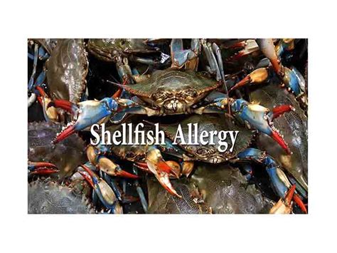 Shellfish Allergy, Symptoms, Treatment, management - Allergy Cure