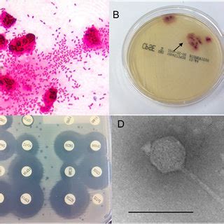 Phages on antibiogram plates.: Two examples of antibiogram agar plates... | Download Scientific ...