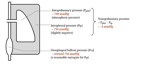 Transpulmonary pressure as a guide for therapy | Deranged Physiology