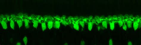 Horizontal cells – Retinal Microscopy