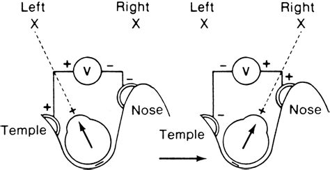 Foundation Volume 2, Chapter 104. Electro-oculography