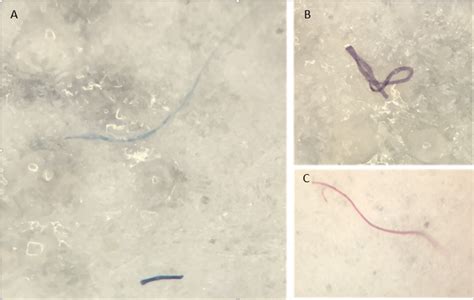 In the Deepest Ocean Trenches, Animals Eat Plastic - The Atlantic