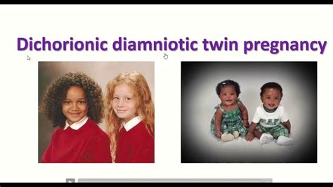 Anatomy Of Dichorionic And Diamniotic Twin Pregnancy With, 40% OFF