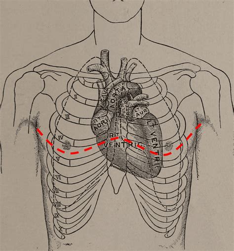 If You’re Going to do the Thoracotomy…do a Clamshell – MED-TAC ...