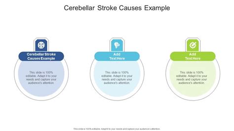 Cerebellar Stroke Causes Example In Powerpoint And Google Slides Cpb