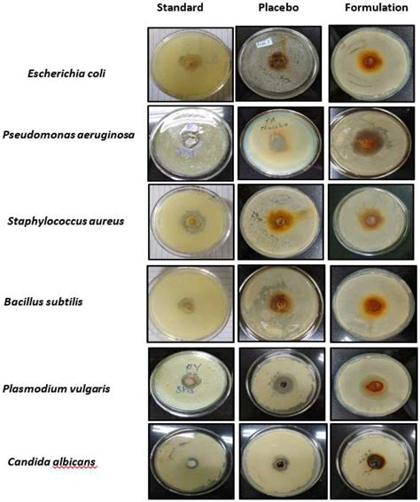 Diffusion disc method of various bacterial and fungal species ...