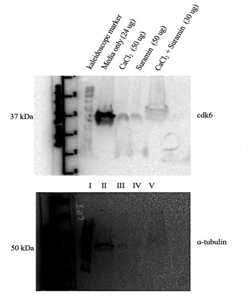 Solved Figure 1: Western blot analysis on the same membrane | Chegg.com