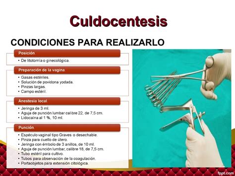 culdocentesis - USA News Collections