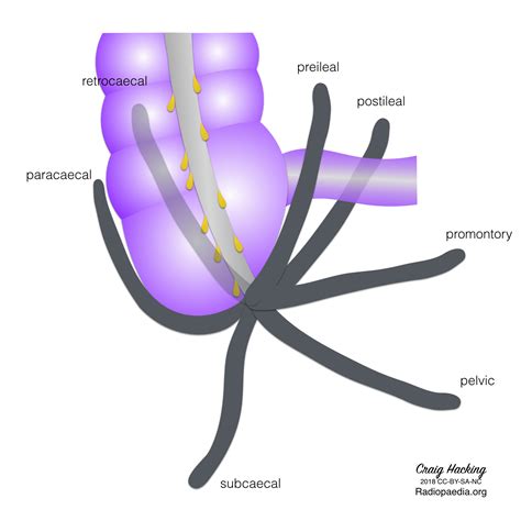 apendicitis por tomografÃ­a | El Blog de Godie