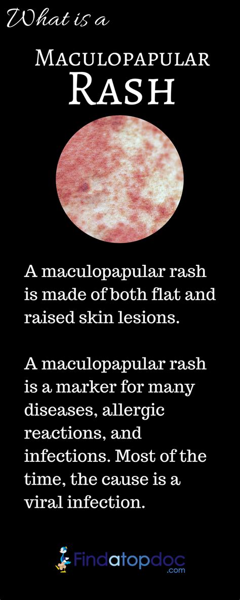 Symptoms of Mono Rash: Infectious Mononucleosis Causes, Treatment