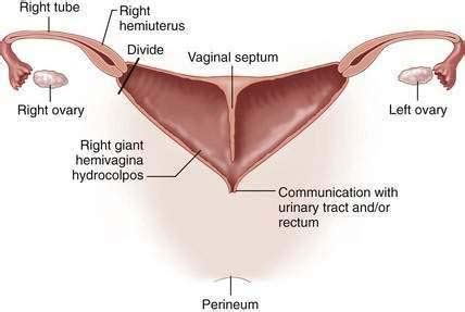 Cloaca | Clinical Gate