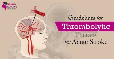 Guidelines for Thrombolytic Therapy for Acute Stroke