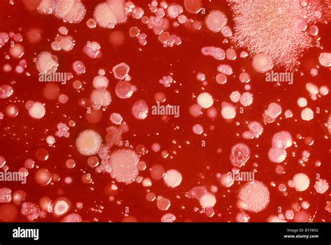 blood agar culture plate growing Bacillus anthracis (anthrax) and other ...