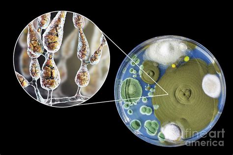 Allergenic Fungus Alternaria Alternata Photograph by Kateryna Kon/science Photo Library - Pixels