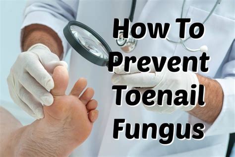 Toenail Fungus – Prevention | Universal Health Products