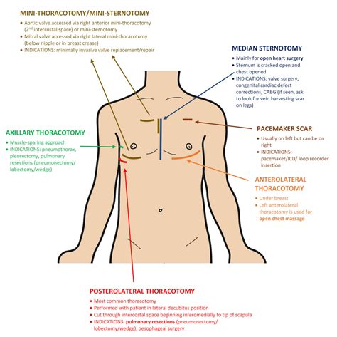 Valve replacements | OSCEstop | OSCE Learning