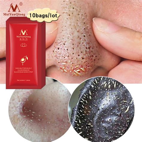 2018 New Style 10PCS Blackhead Remover Nose Mask Pore Strip Black Mask Peeling Acne Treatment ...