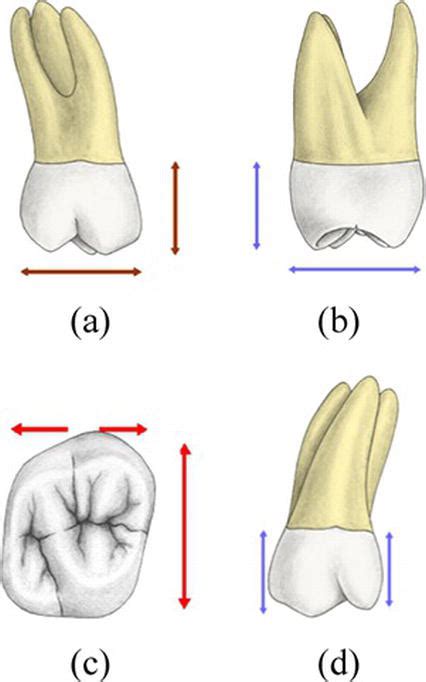 Upper Molar Anatomy