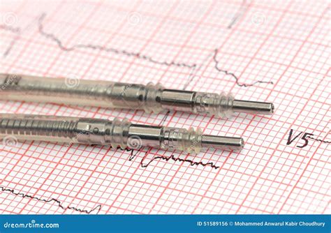 Pacemaker Leads on Electrocardiograph Stock Photo - Image of electrocardiograph, pace: 51589156