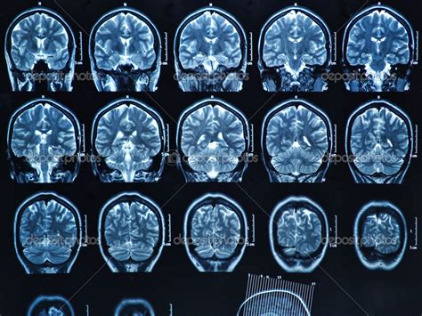 MRI Brain Scan Stock Photo by ©Bunyos30 18723407